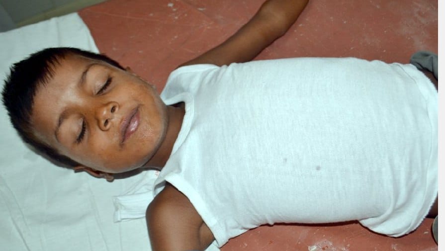 AES affected child found in Palia