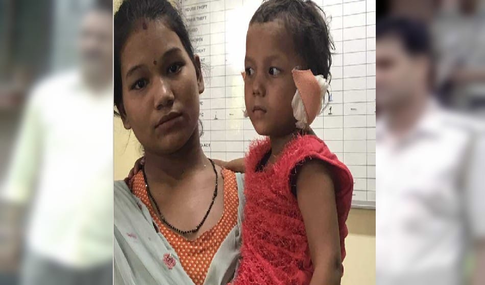 father cut ear of daughter, girl had successful surgery