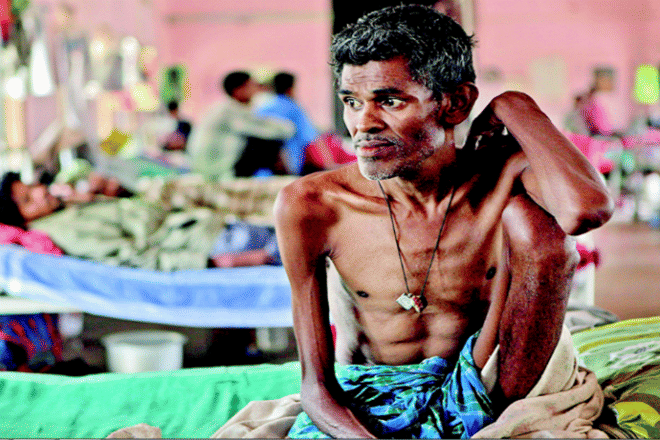 health ministry will provide cash for tb patient adhaar card 