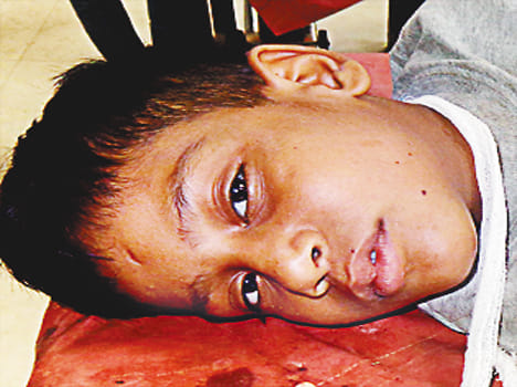 milletry person death in road accident