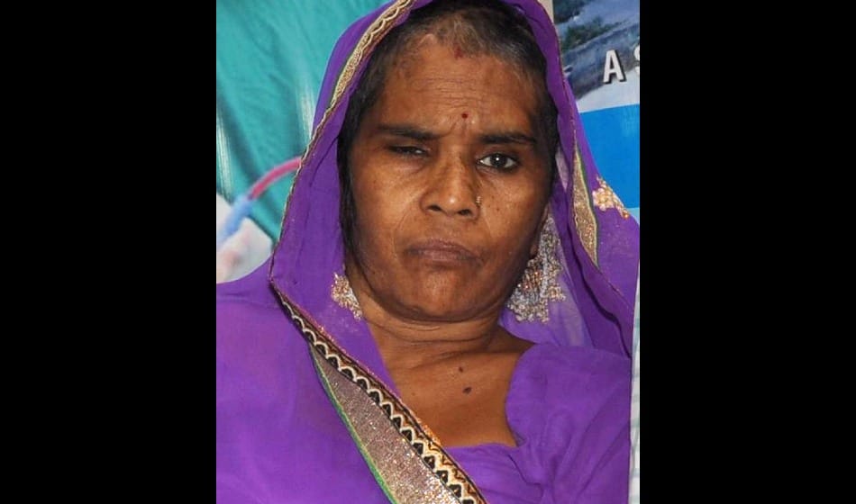  doctor operate 200 gram tumor from old lady brain in delhi 