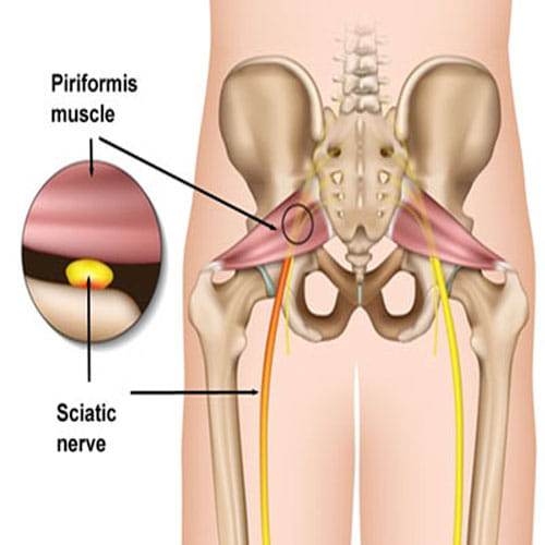 If You keep your purse in your back pocket then be alert, it can put you in trouble, know how