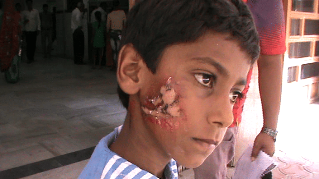 angry father detonate his son with hot stain in ajmer 