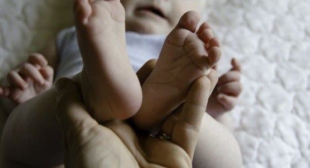 Down syndrome child born in dehradun by doctor Negligence