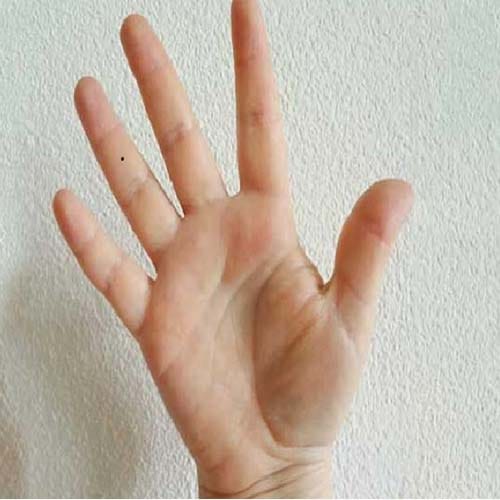 these unlucky moles for money on your palm 