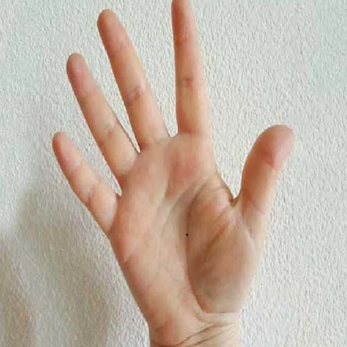 these unlucky moles for money on your palm 