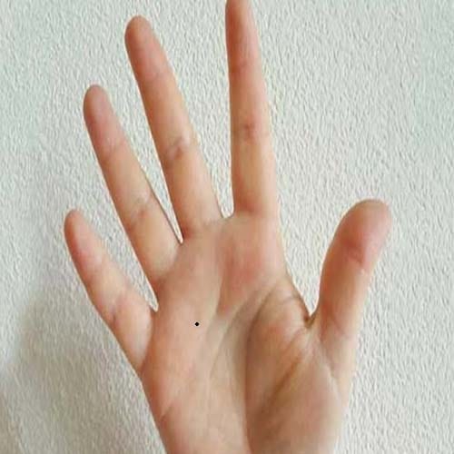 these unlucky moles for money on your palm 