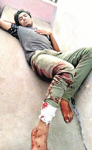 Police encounter with accused of attack on the soldier