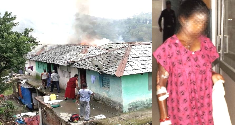 14 Months old Girl Child Burn Alive at Dharamshala.