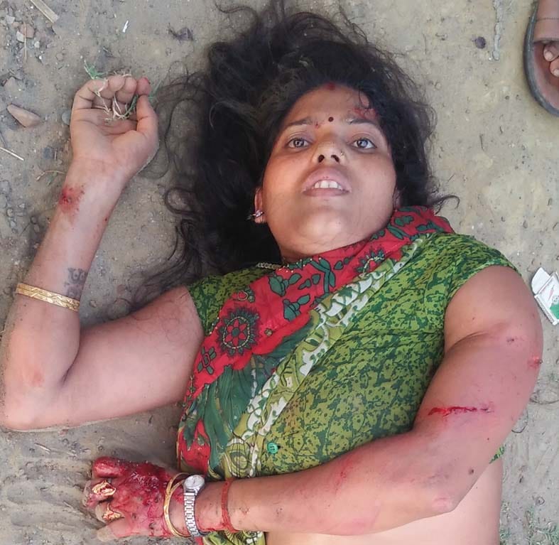 Five injured including doctor couple in road accident.