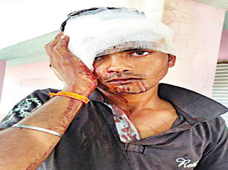 Youth attacked with sharp weapons