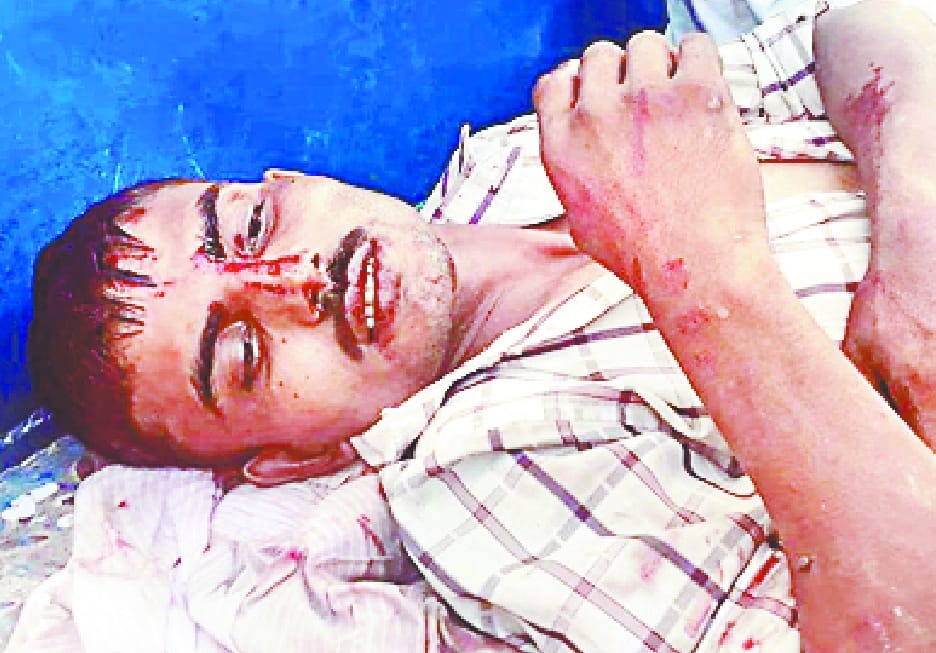 Sangharsh, two wounded in two sides at Paratapur