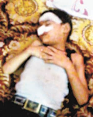accident in raniganj kathola bazar