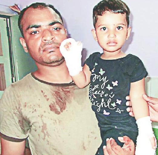 Cut the four fingers of the girl's hand in Bawli