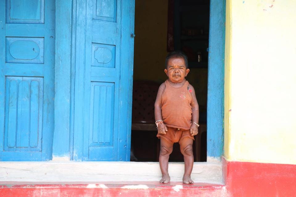 Basori Lal of Madhya Pradesh is just 29 inches tall at the age of 50 years