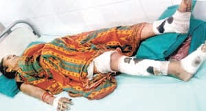 Firing and bombing in Alanganj, mother and son injured