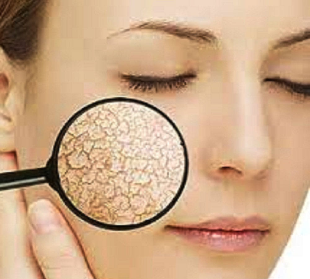 This monsoon these beauty tips will make you tension free from dry skin