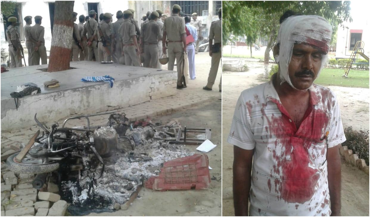 Varanasi Ramanagar rehabilitation centre arson, sabotage fiercely burned and four injured