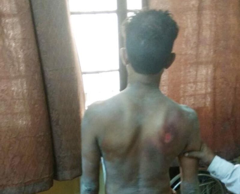 अर्द्धविक्षिप्त को बाइक से बांधकर पचास मीटर तक घसीटा