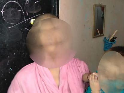 A woman tortured for dowary in Lucknow.