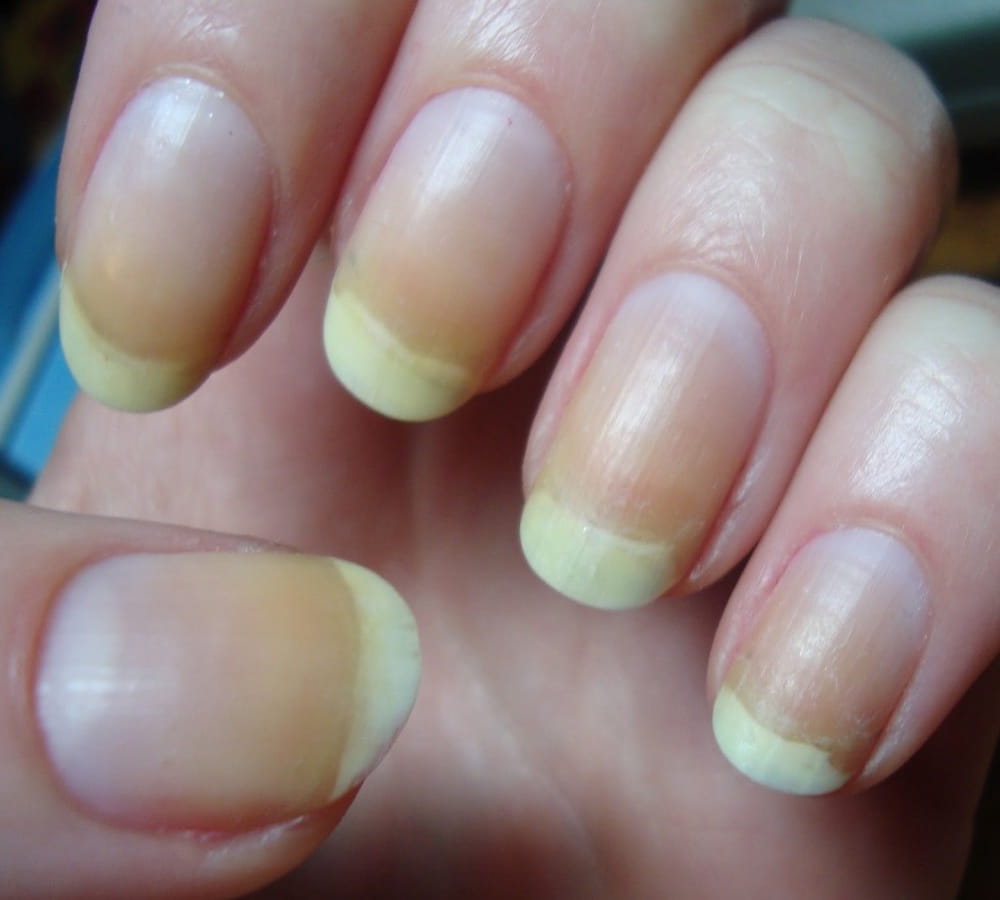 your nails tells about your health