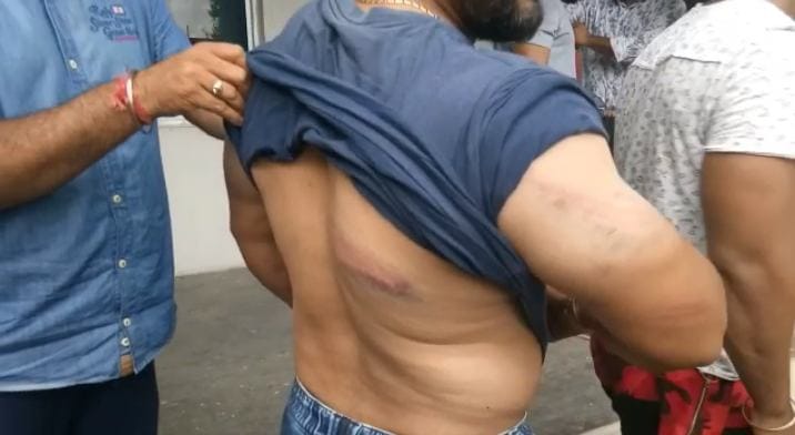 police shows their cruel face