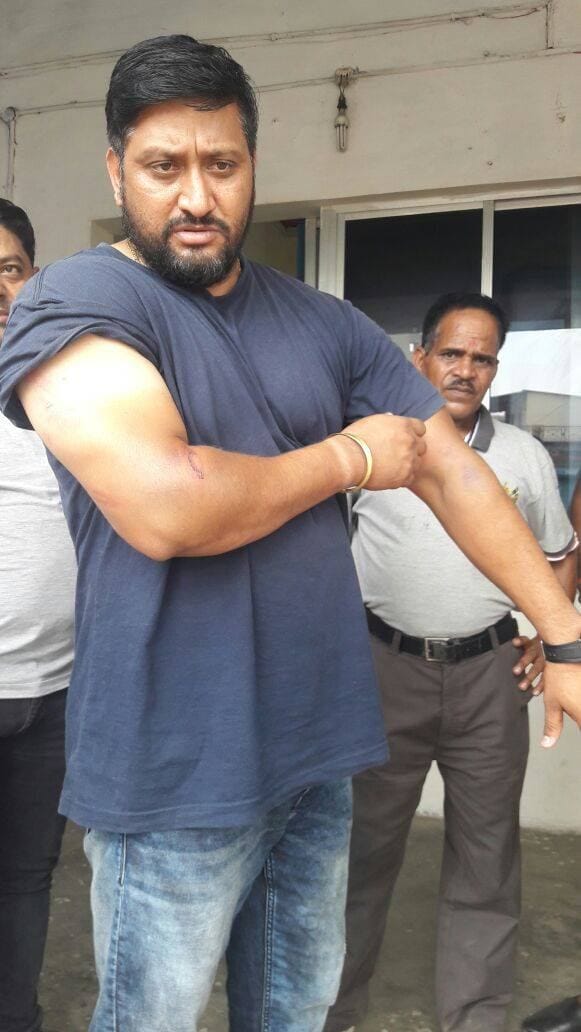 police shows their cruel face