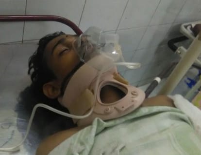 student injured during taking selfie in lucknow