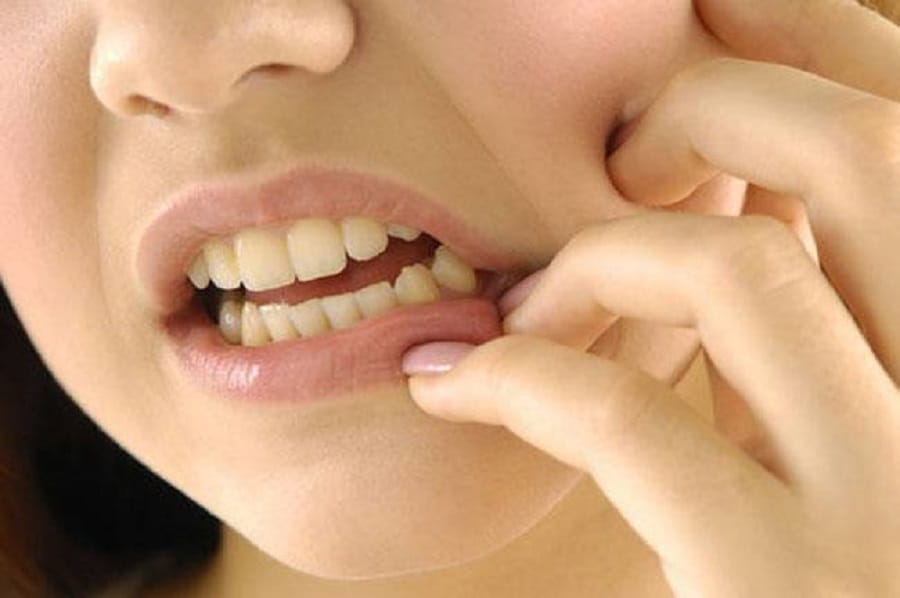 Modi flower has magical cure for mouth ulcer