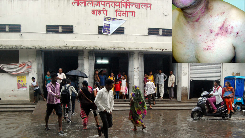 number of skin patients increased