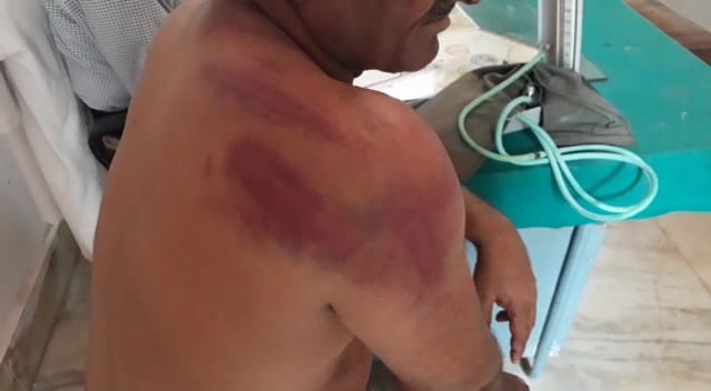 forest officials badly beaten up by the villagers in national park jaisalmer 