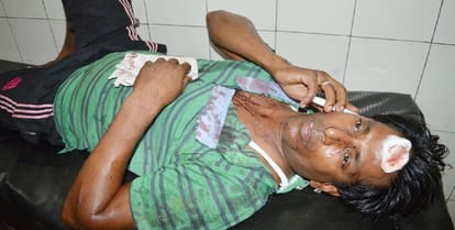 The ruckus caused to rotate the dog, after the assault, stone, communal tension
