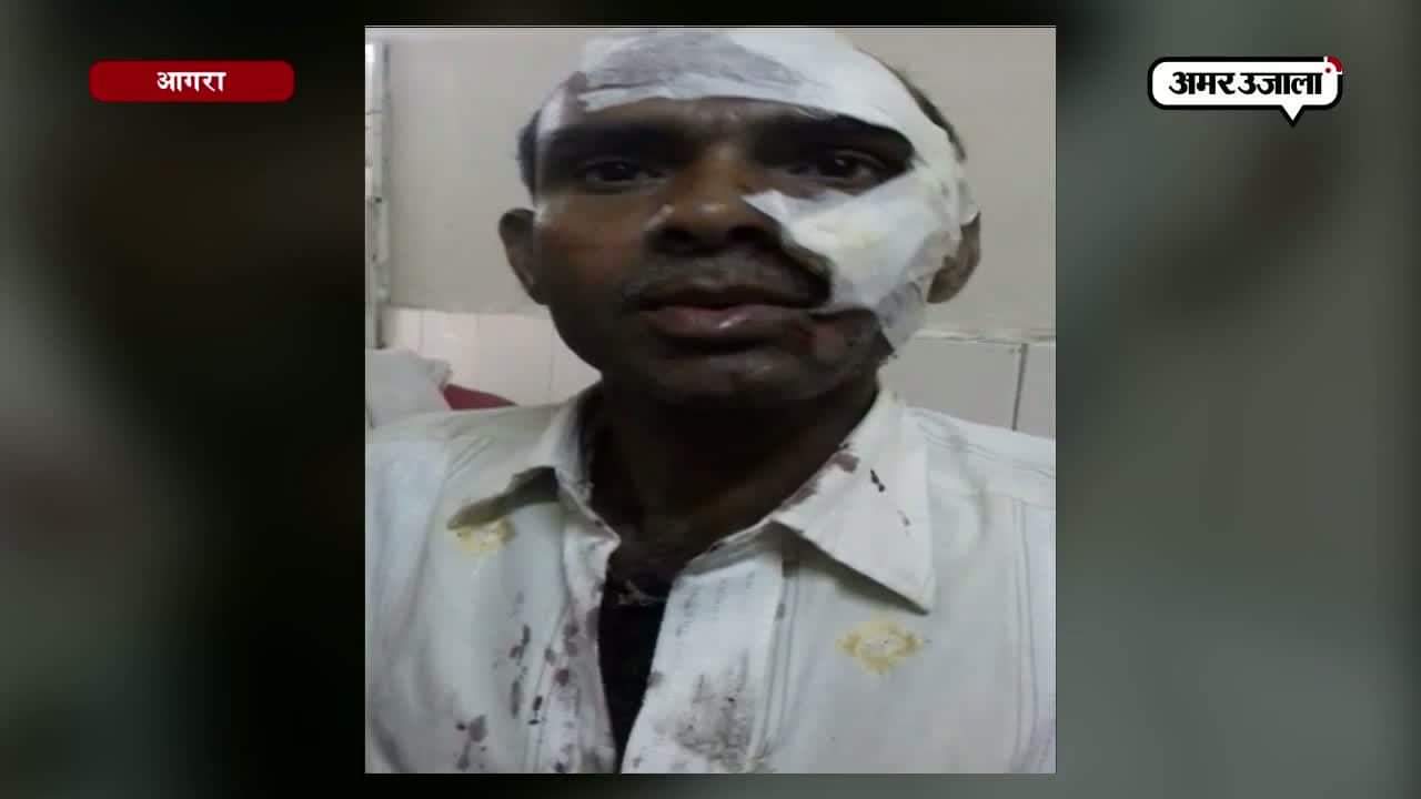 आगरा एक्सीडेंट