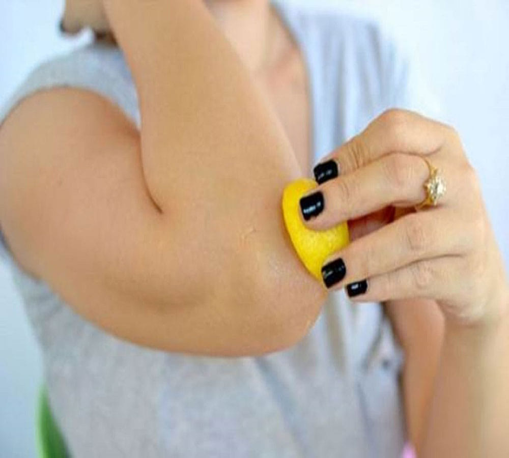 home remedies to get rid of dark elbow