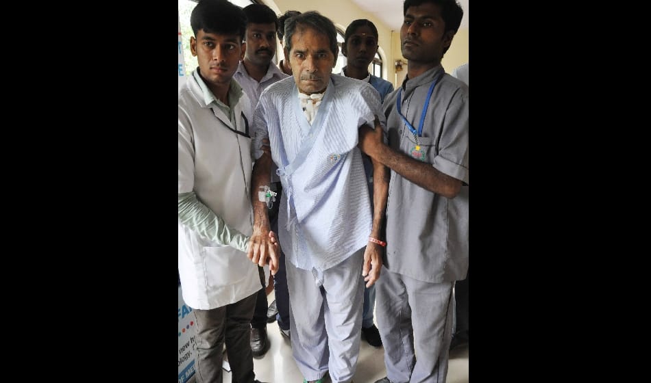 doctors found more than 150 pins and Needle from 56 years man