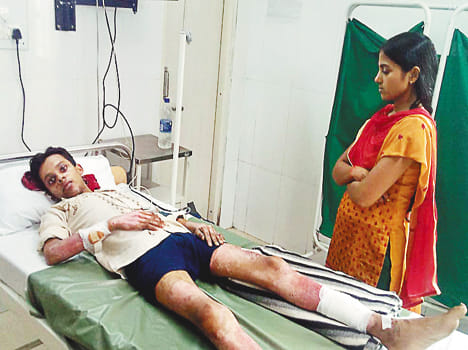 Two injured in the blast case