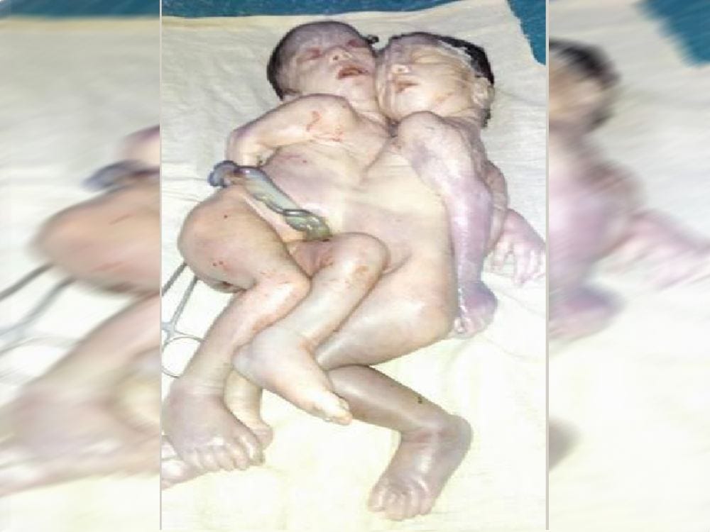 strange baby girl birth in kichha