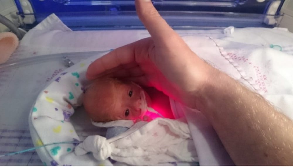 Premature baby saved after doctors put her in plastic bag
