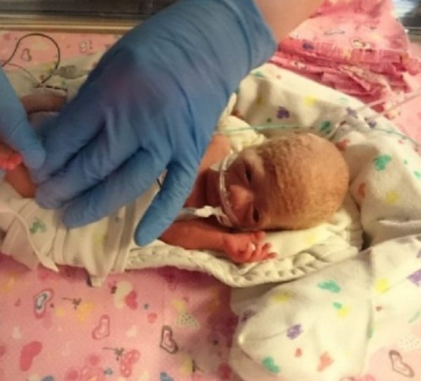 Premature baby saved after doctors put her in plastic bag