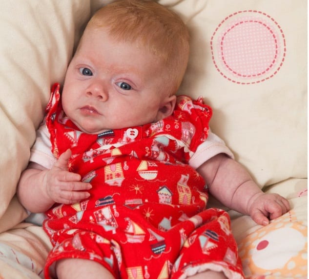 Premature baby saved after doctors put her in plastic bag