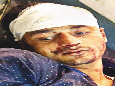 Two shotguns shot, two  injured