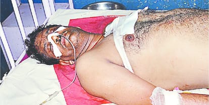 Daughter on the life to save father, the young man raised this step