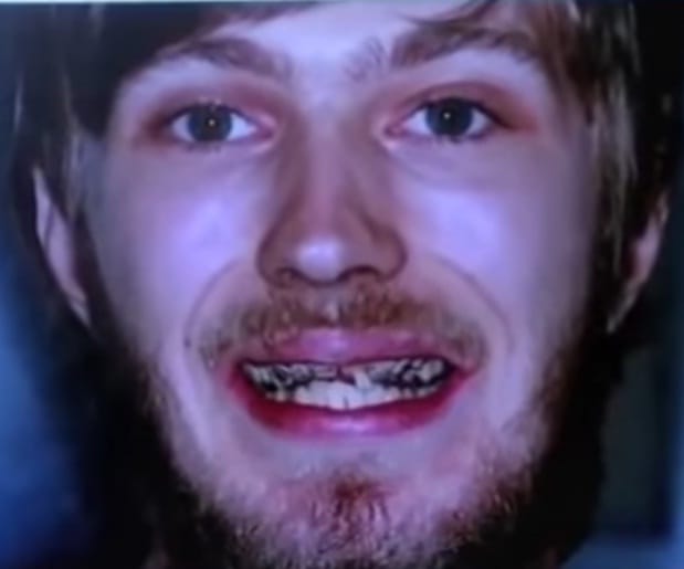 Guy confess he did not brush his teeth for 20 years