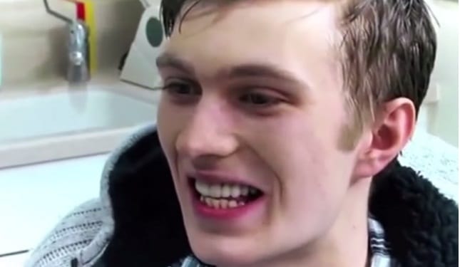 Guy confess he did not brush his teeth for 20 years