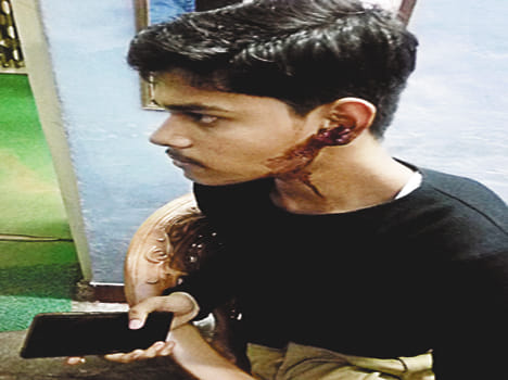 MLA supporters beaten by youth