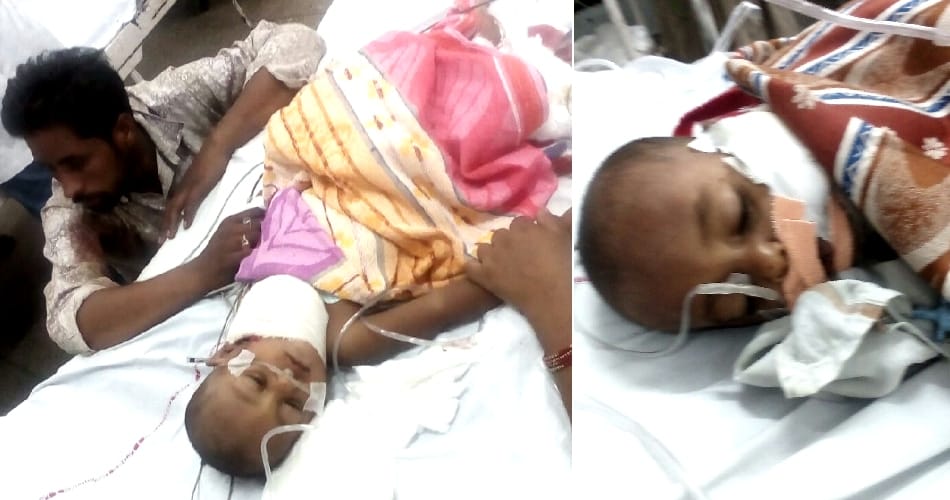 One-and-a-half-year-old kid was bitten by a mad dog
