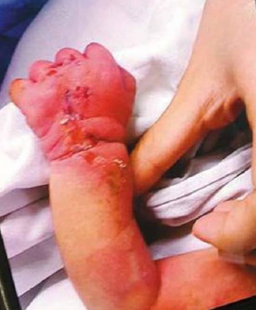 Mother accused of cannibalism caught eating her newborn baby
