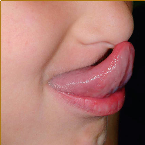 do you know Your Teeth affect Your Happy Life