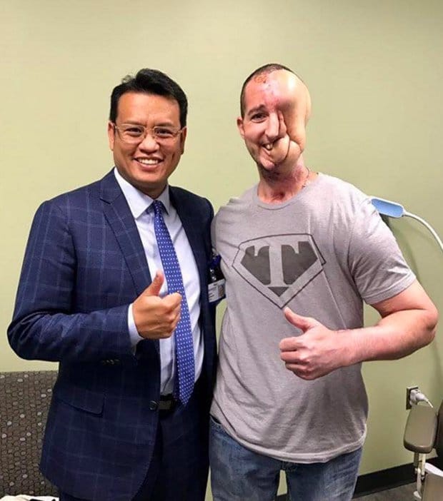 Michigan man lost half face to Synovial Sarcoma doctors built his face with legs