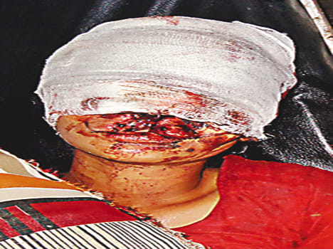 The young man hanged his wife injured